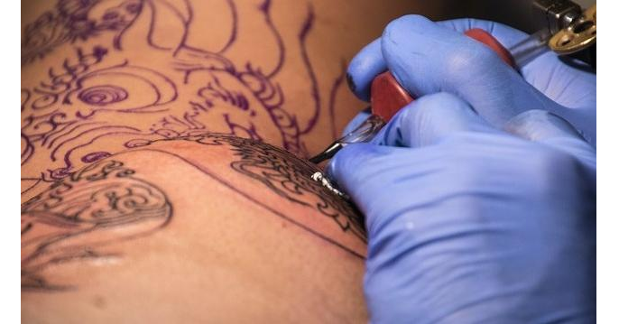 Tattoo Entzundet Was Sie Nun Tun Konnen Chip