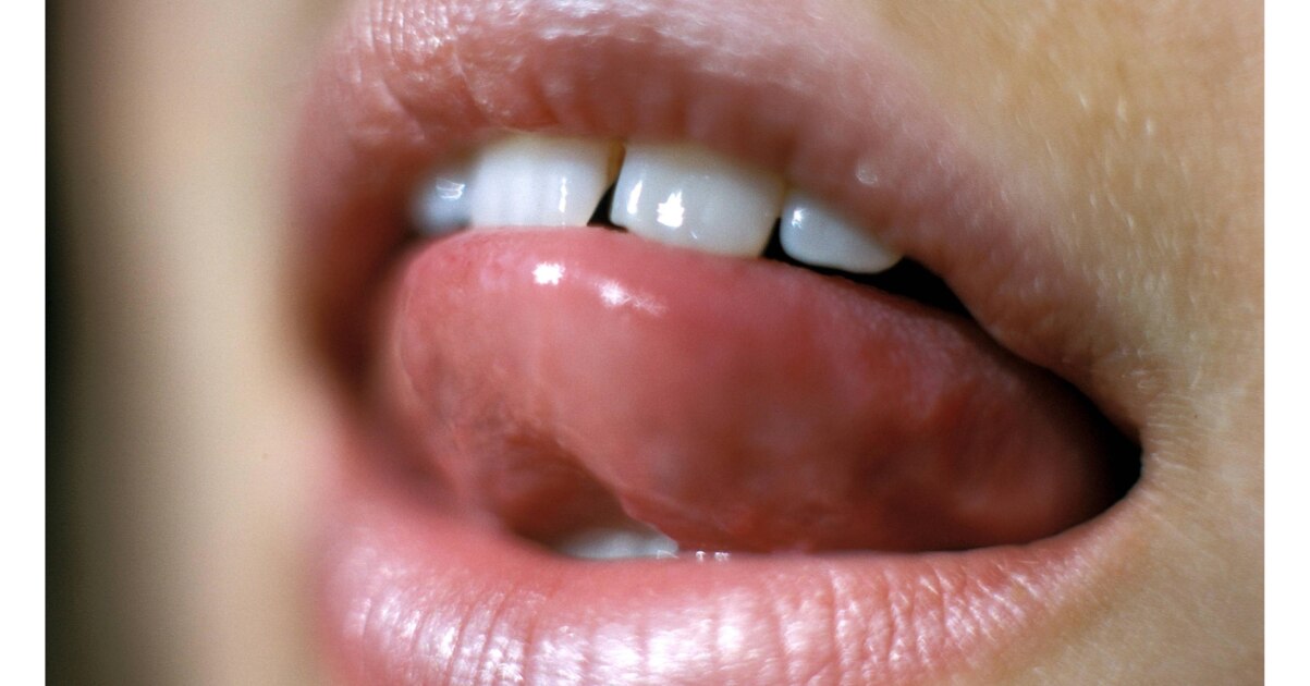 Metallischer Geschmack Im Mund Das Mussen Sie Wissen Focus De Metallischer Geschmack Im Mund Das Mussen Sie Wissen Focus De