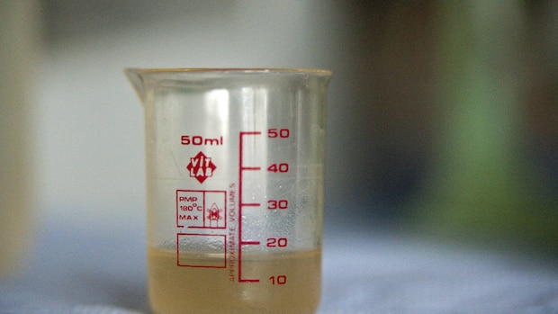 Milliliter (ml) in Gramm (g) umrechnen: So geht's einfach